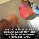 Rama, plaga